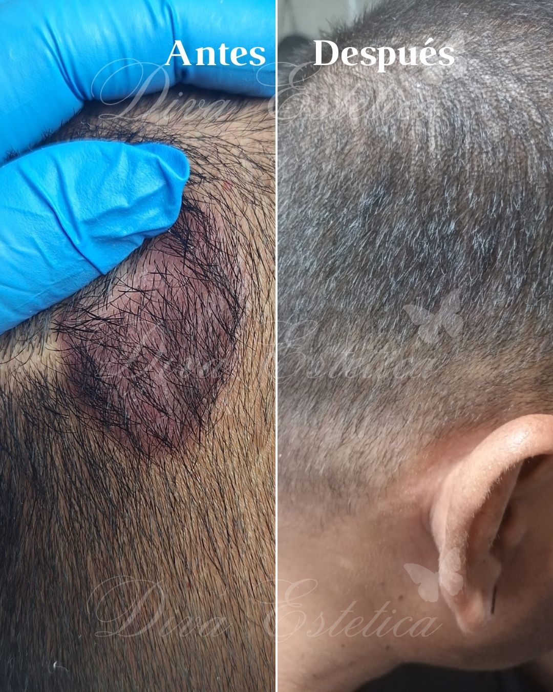 Tratamiento capilar + shampoo